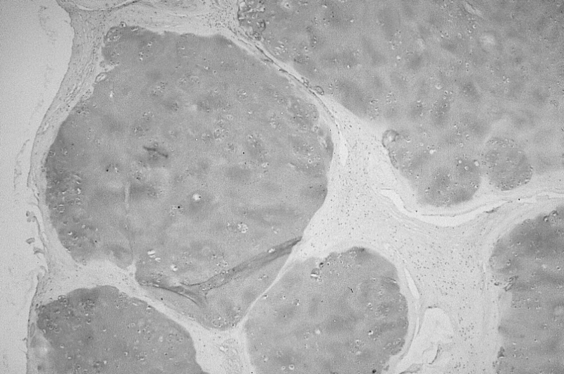 Synovial Tissue