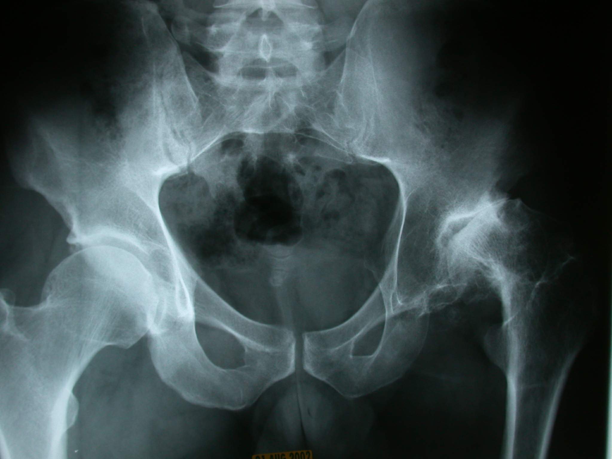 beaule figure 2a.jpg beaule figure 2a.jpg