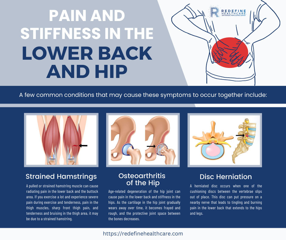 Pain and Stiffness in the Lower Back and Hip 