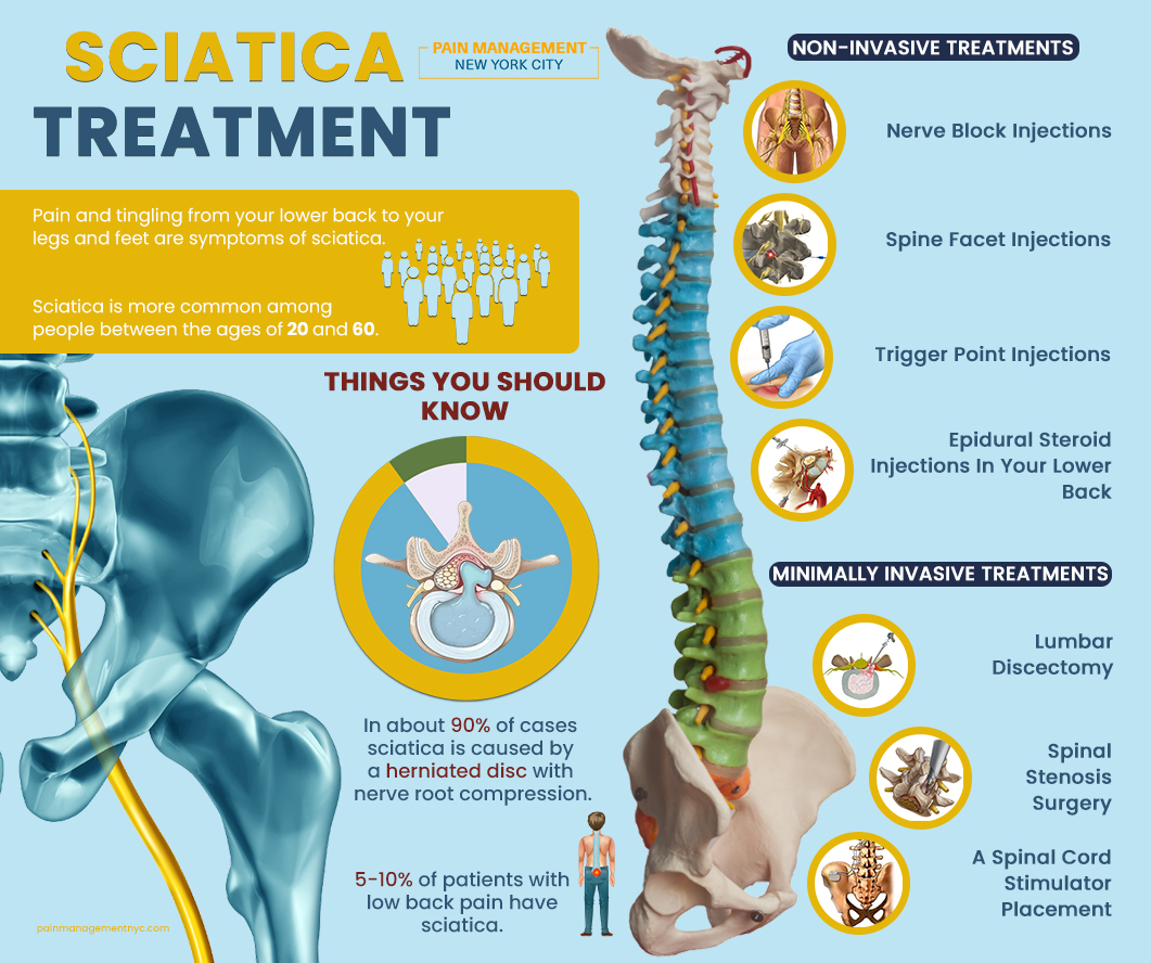 Sciatica Treatment
