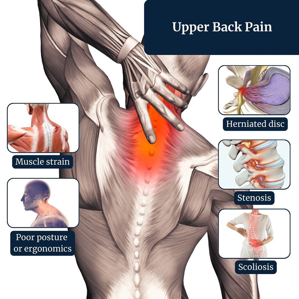 upper-back-pain-treatment-irving-tx