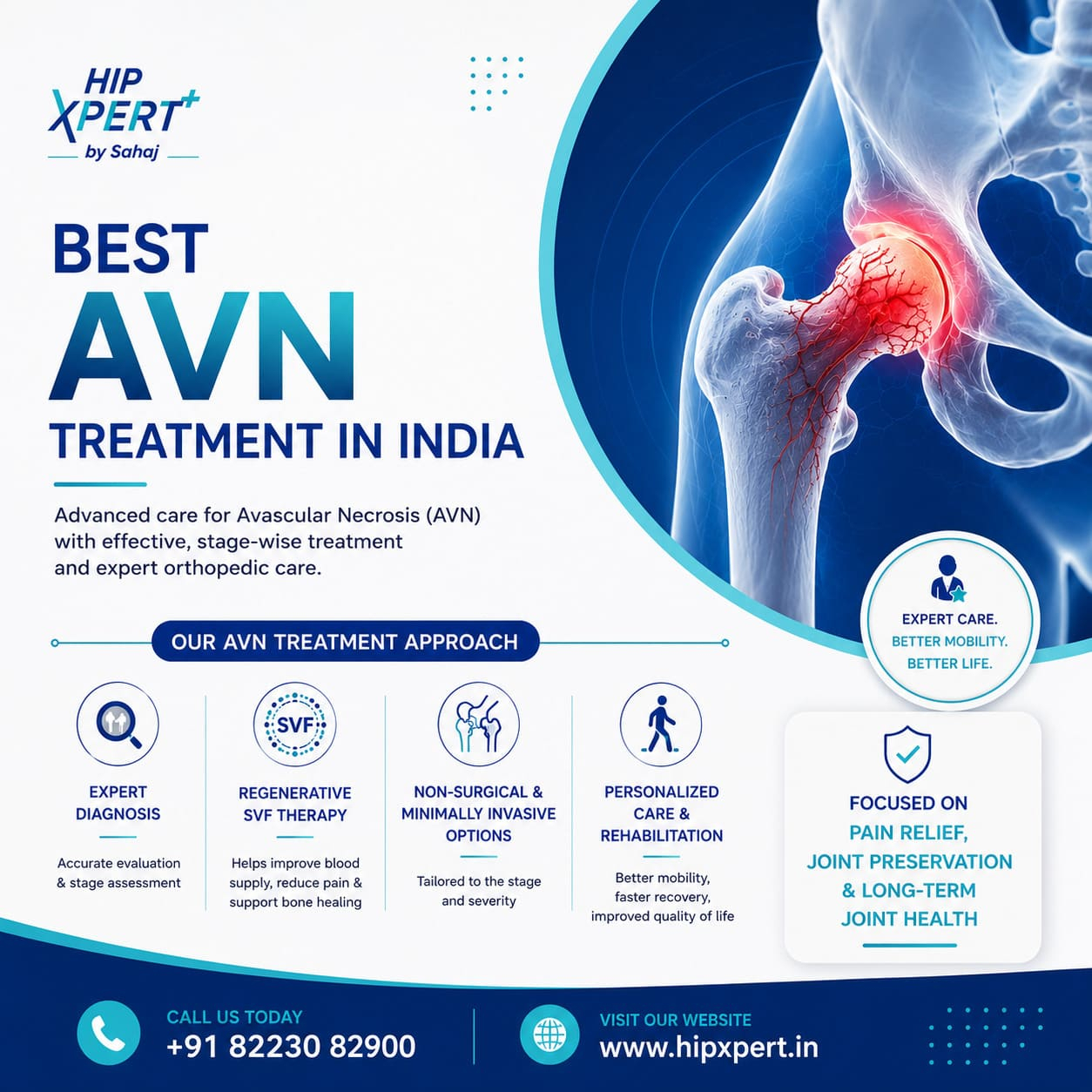 Best AVN Treatment in India