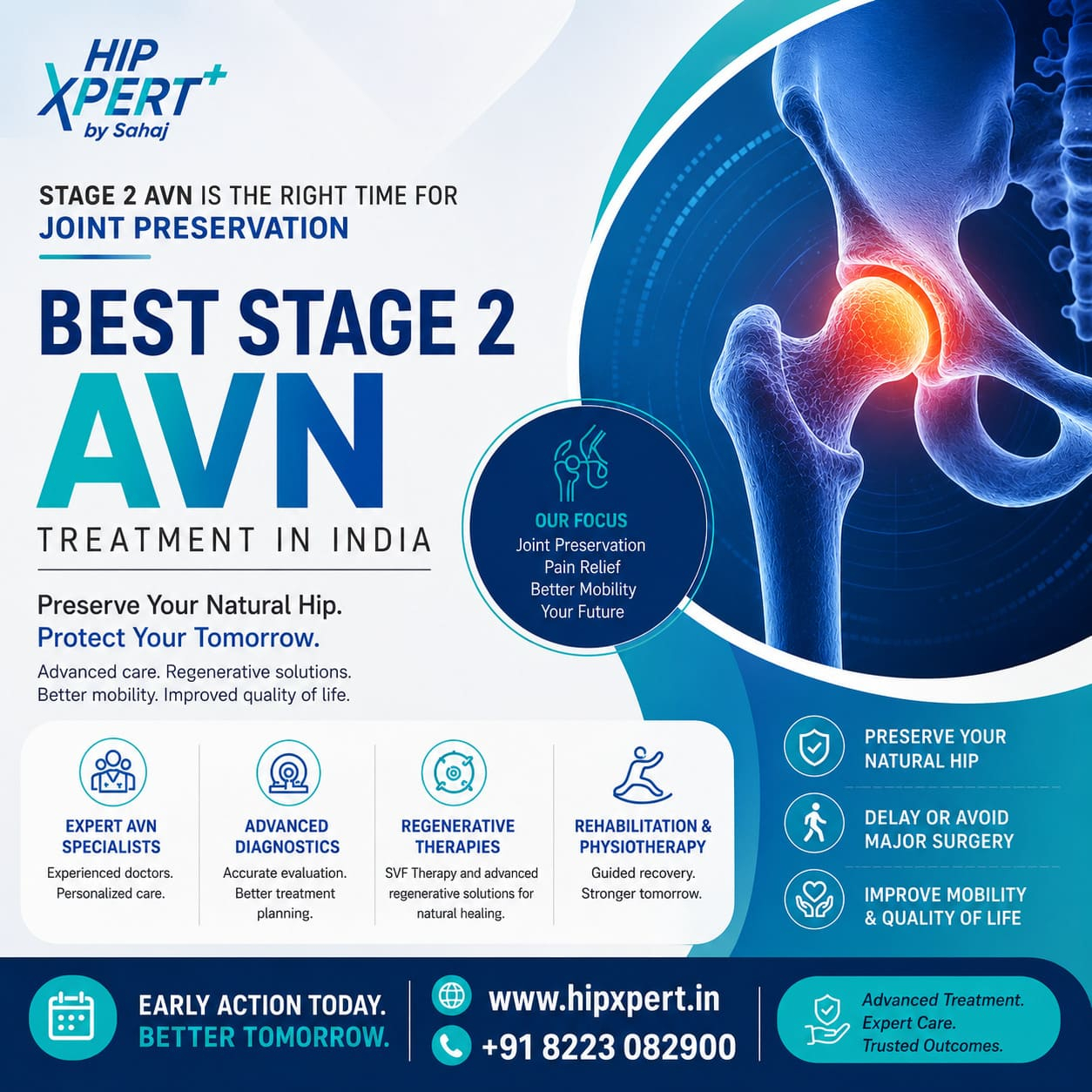 Best Stage 2 AVN Treatment in India