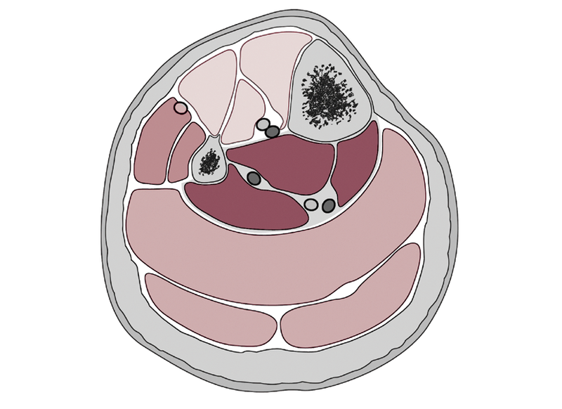 Anatomy