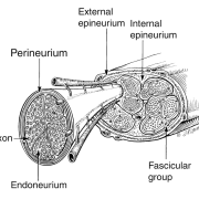 compression-neuropathies