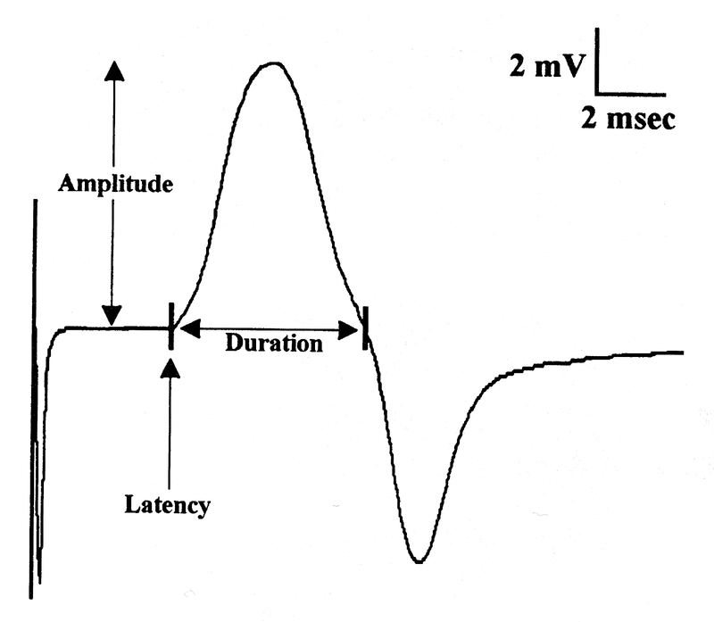 Electrodiagnostic Studies