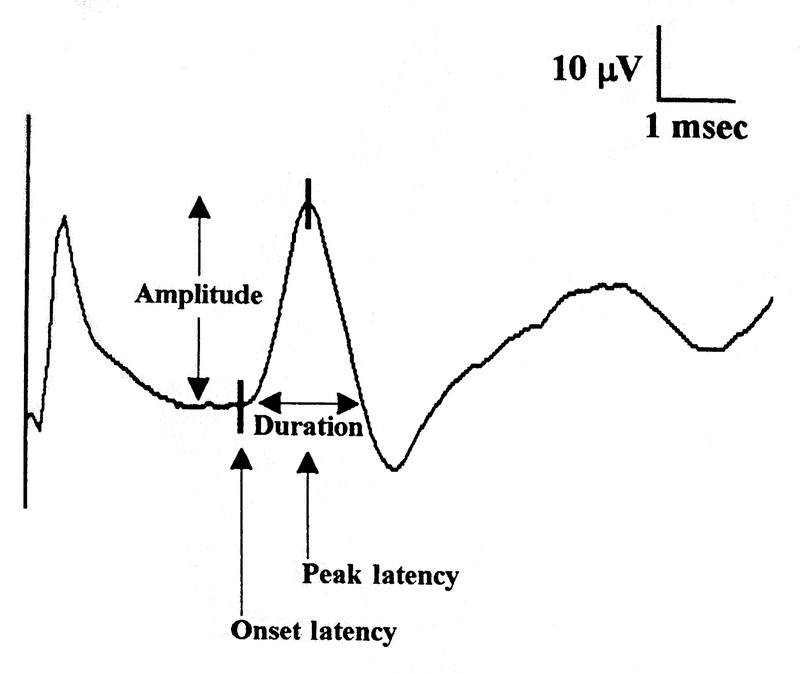 Electrodiagnostic Studies