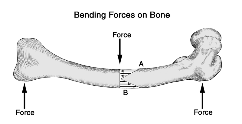 Fracture