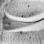 meniscus-and-intervertebral-disks