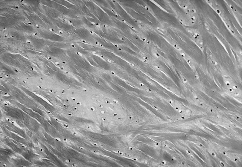 Meniscus and Intervertebral Disks