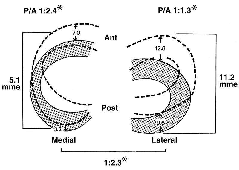 Meniscus and Intervertebral Disks