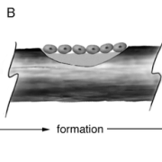 metabolic-bone-disease
