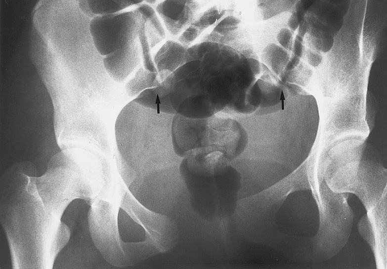 Musculoskeletal Aspects of Trauma