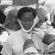 musculoskeletal-aspects-of-trauma