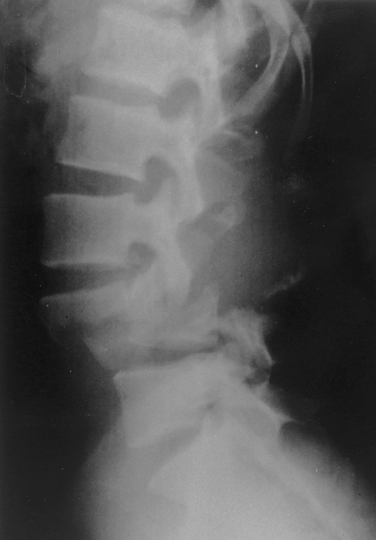 Musculoskeletal Aspects of Trauma