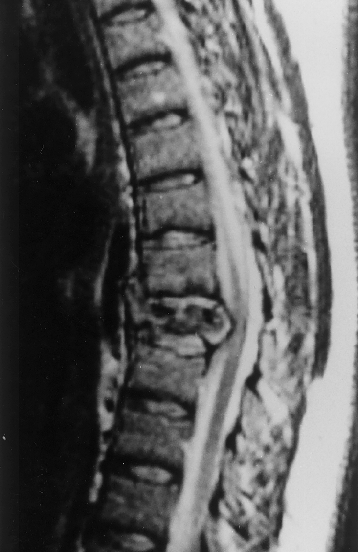 Musculoskeletal Aspects of Trauma