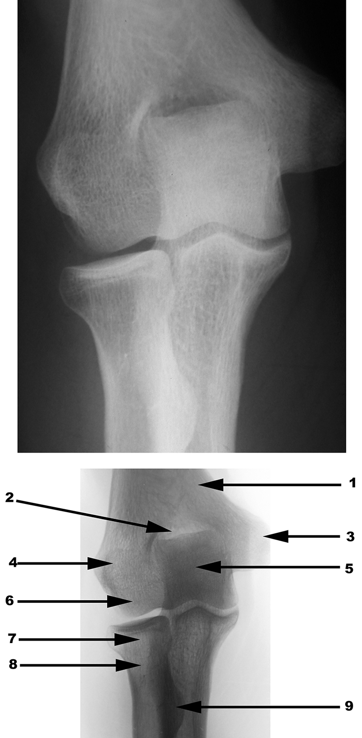 Radiography
