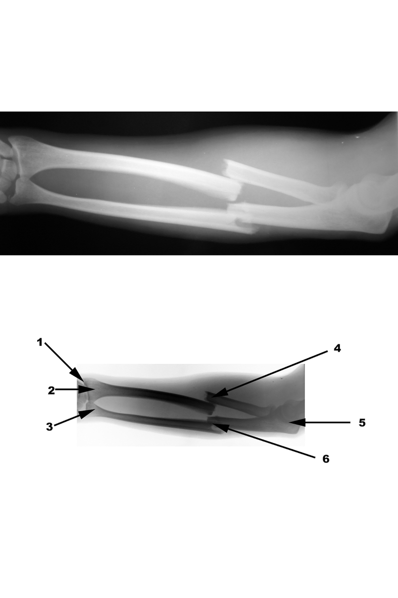 Radiography