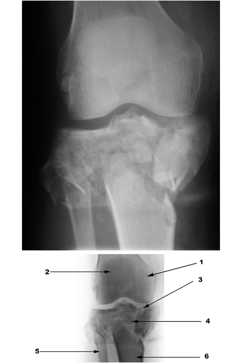 Radiography