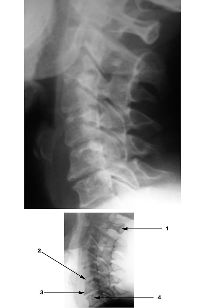 Radiography