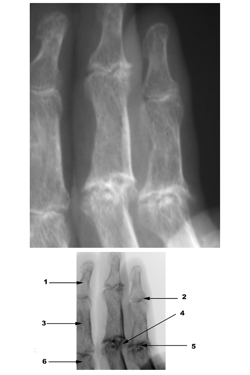 Radiography