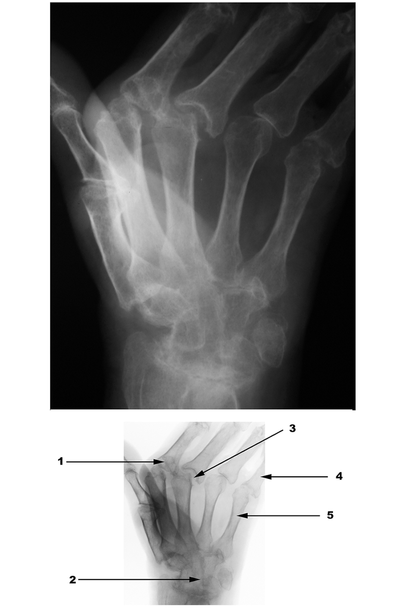 Radiography
