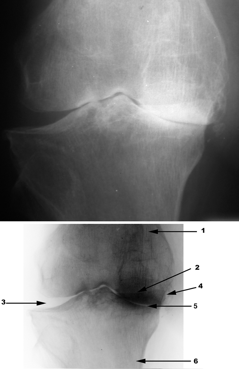 Radiography