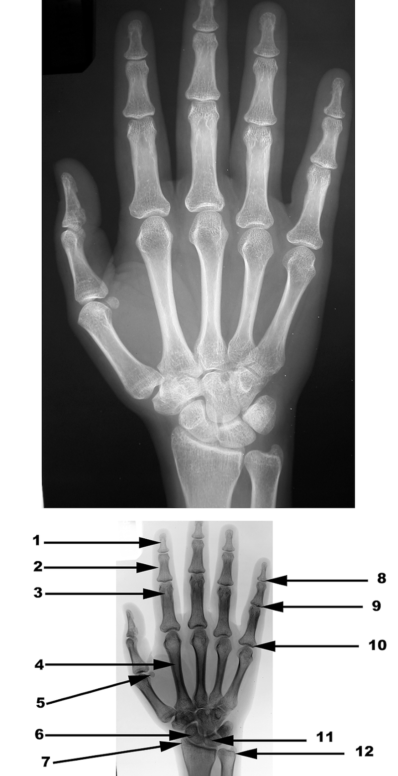 Radiography