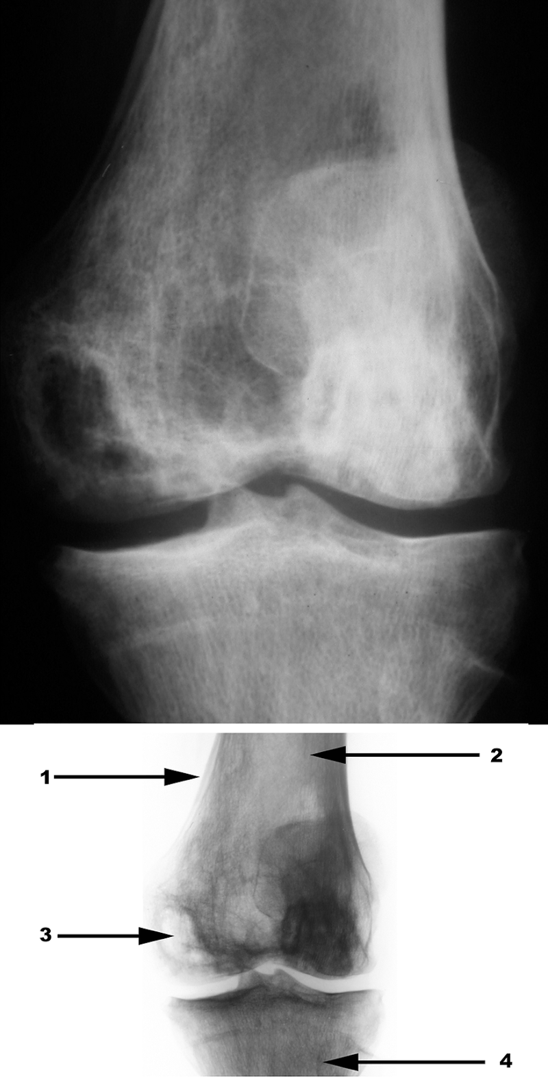Radiography