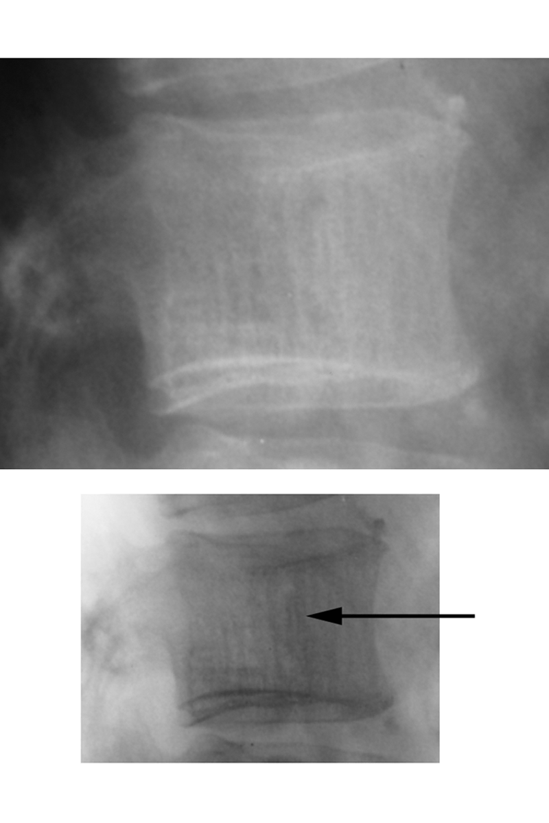 Radiography
