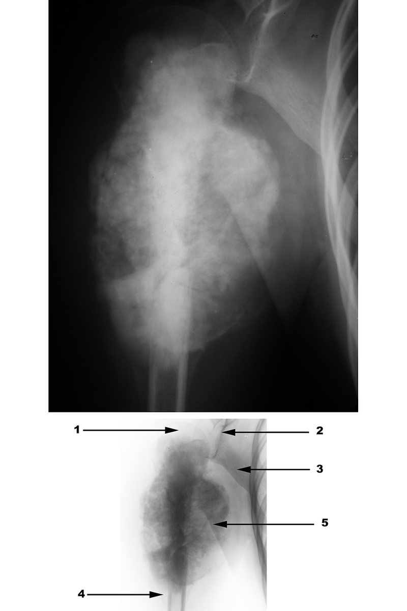 Radiography
