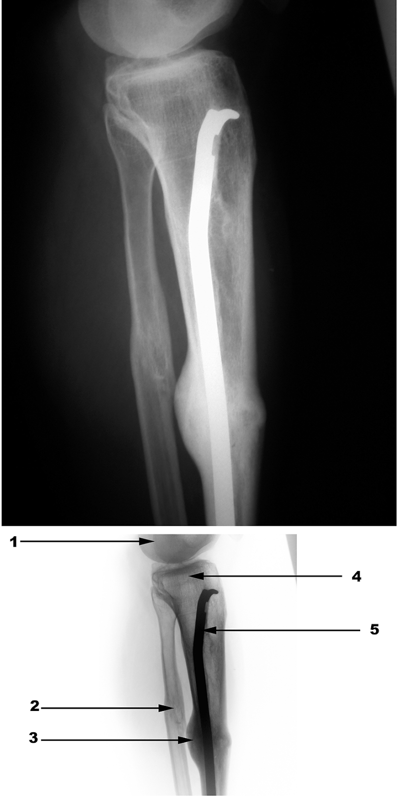 Radiography