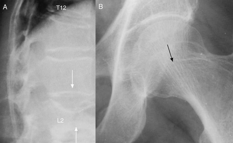 Radiography