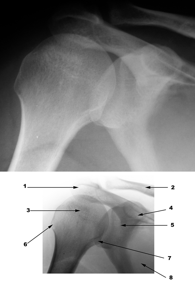 Radiography
