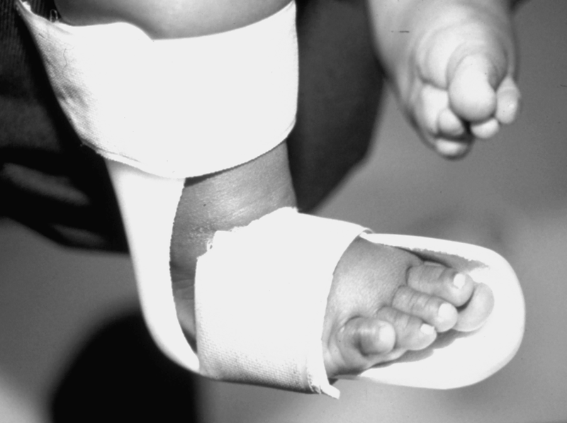 Special Concerns of the Pediatric Patient