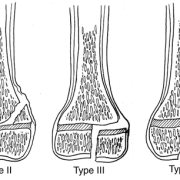 special-concerns-of-the-pediatric-patient