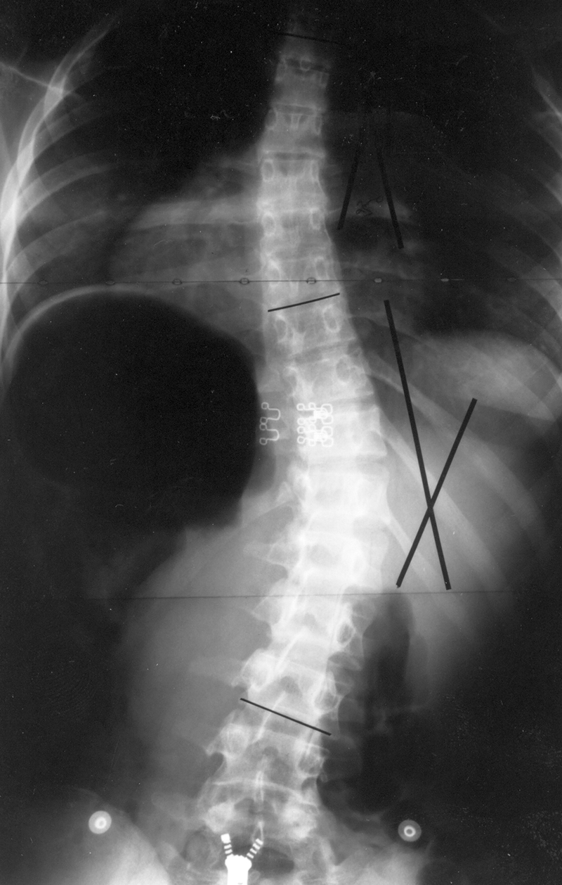 Special Concerns of the Pediatric Patient