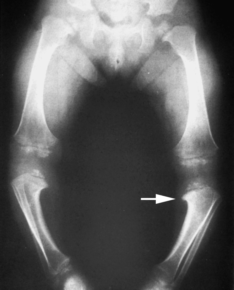 Special Concerns of the Pediatric Patient
