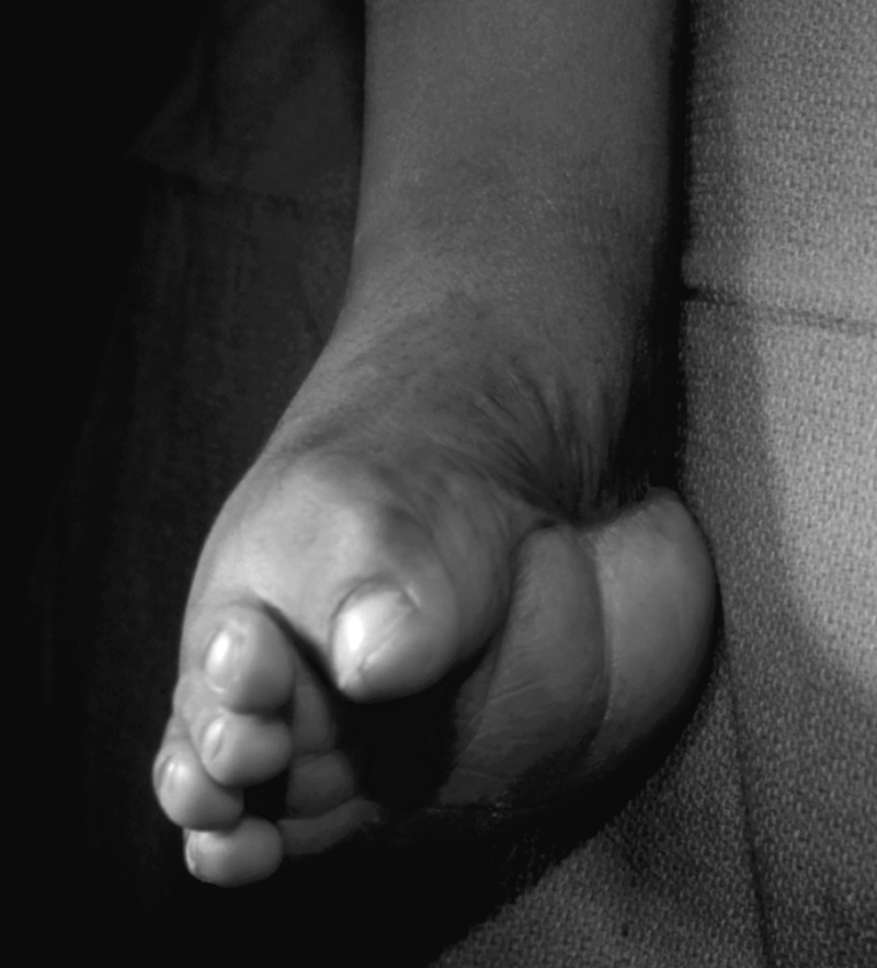 Special Concerns of the Pediatric Patient