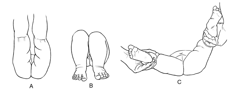 Special Concerns of the Pediatric Patient