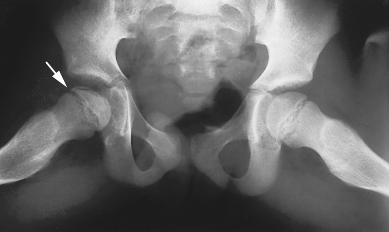 Special Concerns of the Pediatric Patient