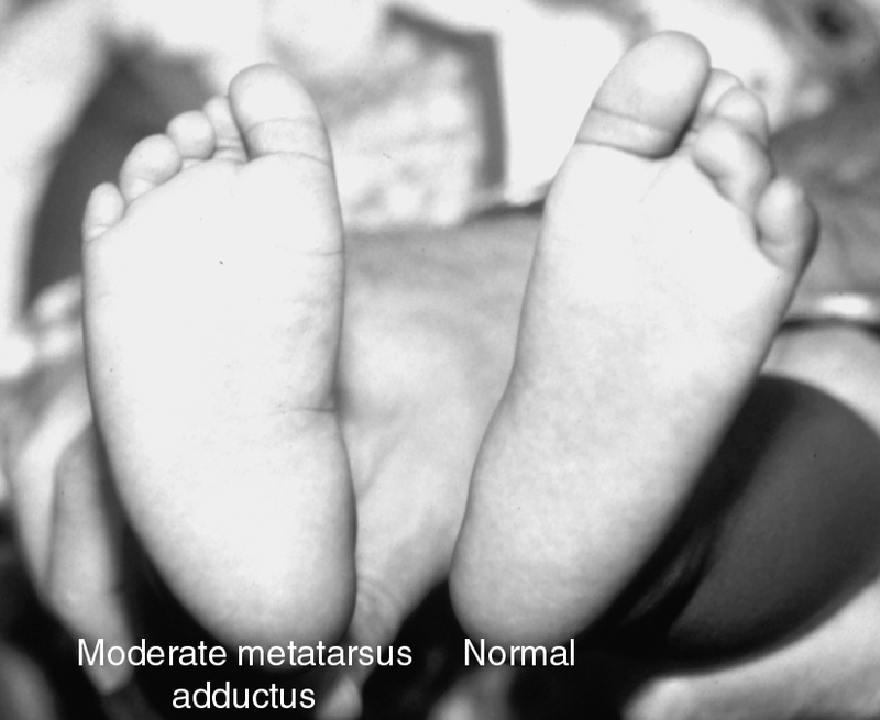 Special Concerns of the Pediatric Patient