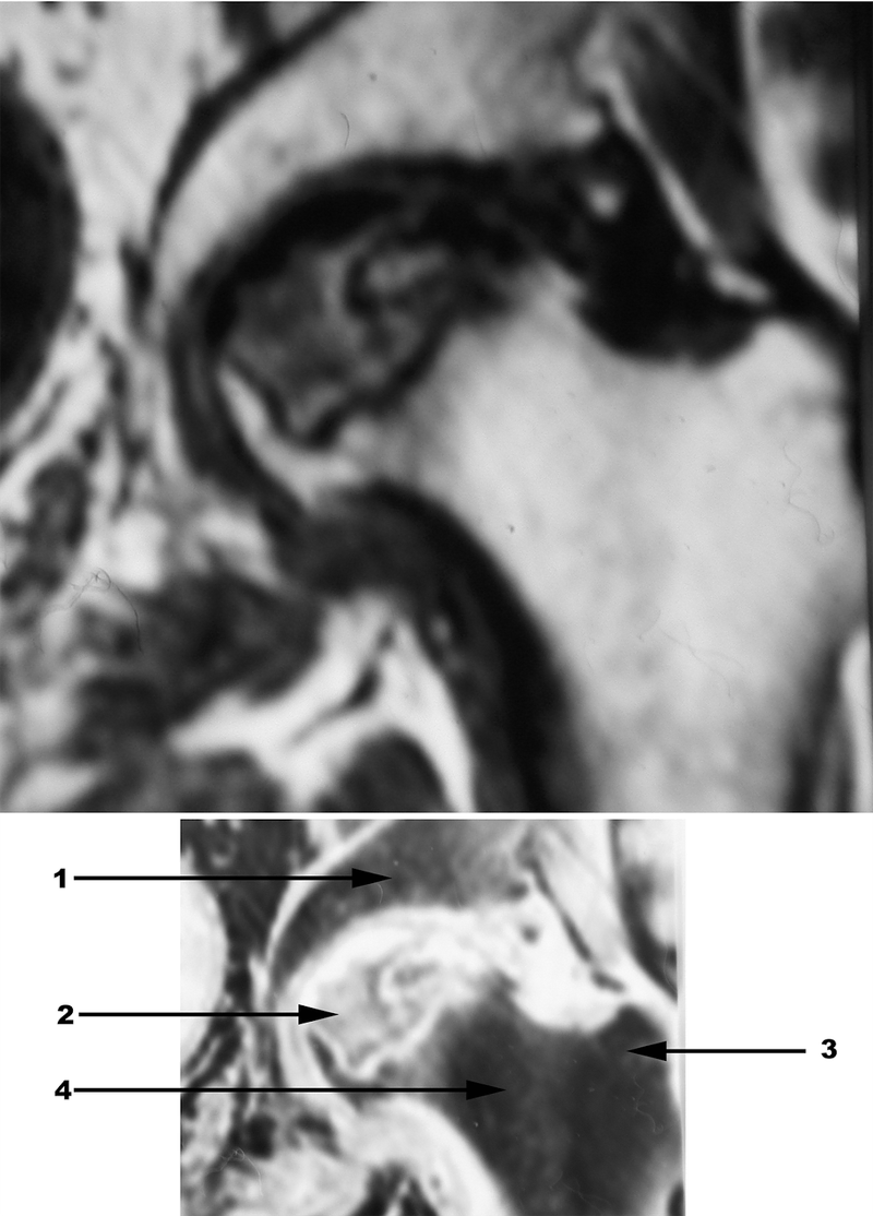 Special Imaging Studies