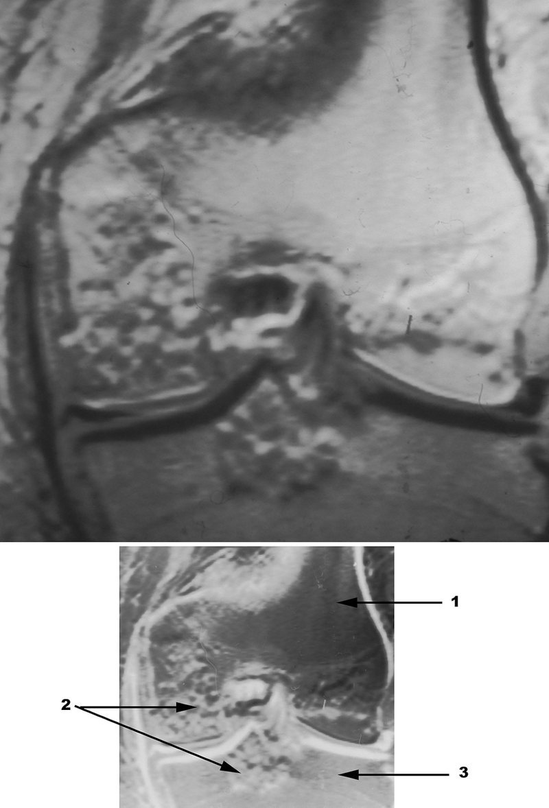 Special Imaging Studies