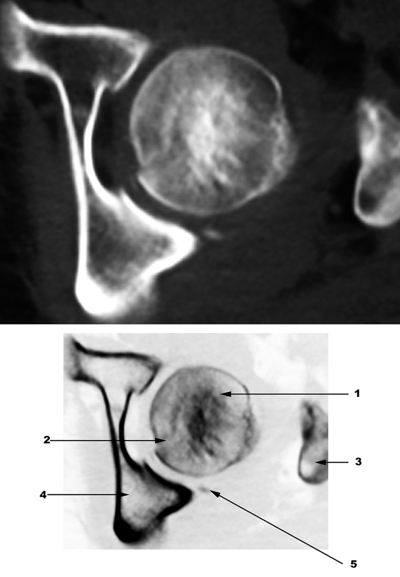 Special Imaging Studies