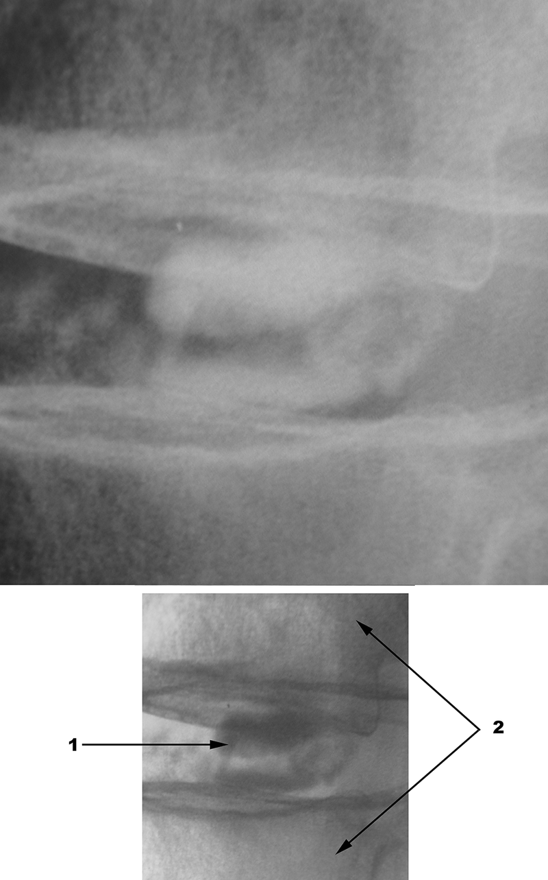 Special Imaging Studies