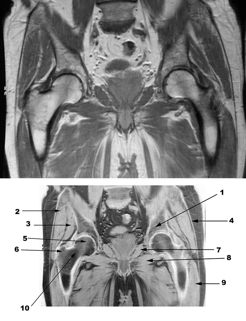 Special Imaging Studies