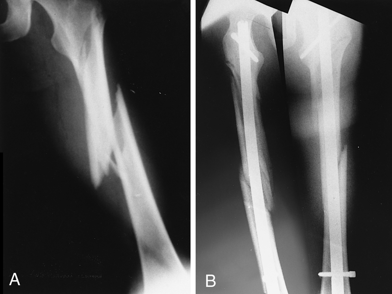 Surgical Treatments