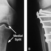 surgical-treatments