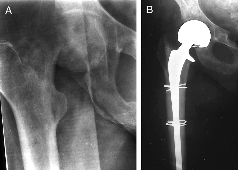 Surgical Treatments